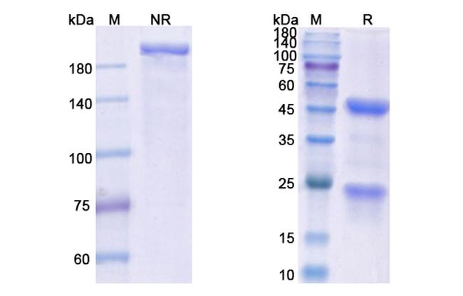 14F7 Antibody in SDS-PAGE (SDS-PAGE)