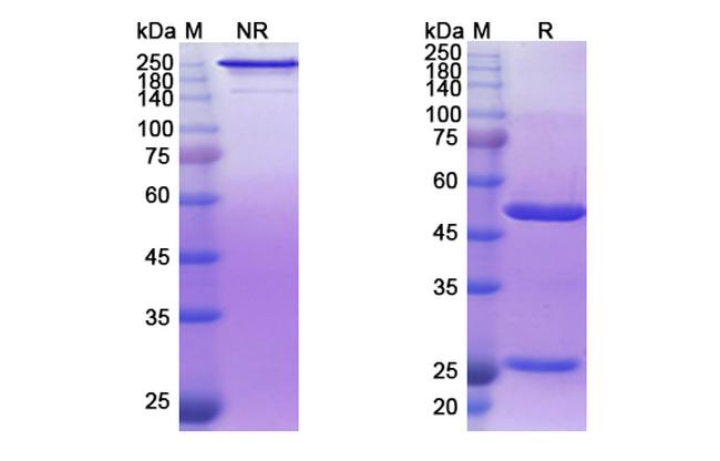 Derlotuximab Chimeric Antibody in SDS-PAGE (SDS-PAGE)