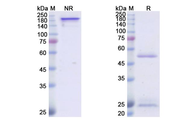 ICM3 Antibody in SDS-PAGE (SDS-PAGE)