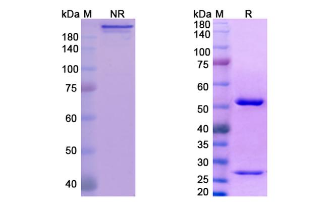 ABX-IL8 Antibody in SDS-PAGE (SDS-PAGE)