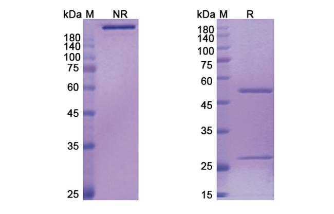 Bertilimumab Antibody in SDS-PAGE (SDS-PAGE)
