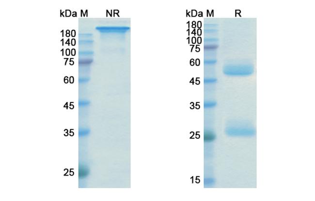Ustekinumab Antibody in SDS-PAGE (SDS-PAGE)
