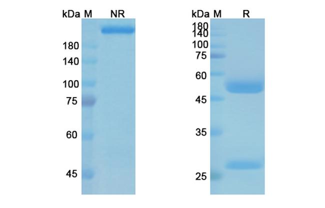 Ipilimumab Antibody in SDS-PAGE (SDS-PAGE)