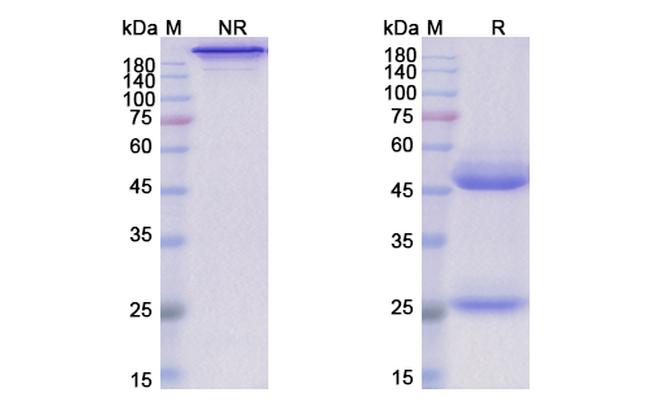 Lerdelimumab Antibody in SDS-PAGE (SDS-PAGE)