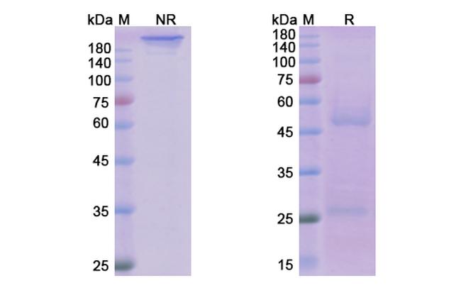 Ofatumumab Antibody in SDS-PAGE (SDS-PAGE)