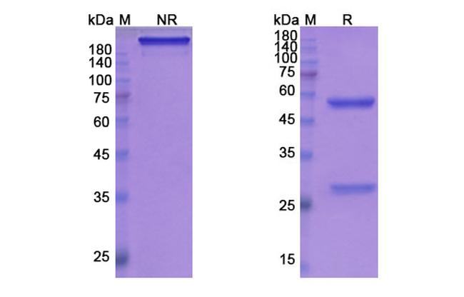 Gantenerumab Antibody in SDS-PAGE (SDS-PAGE)