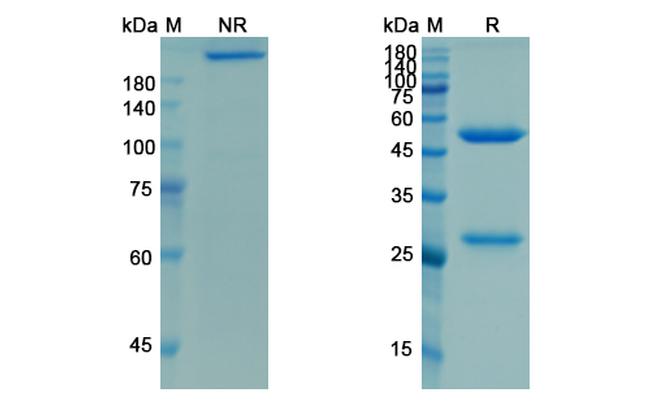 Racotumomab Antibody in SDS-PAGE (SDS-PAGE)
