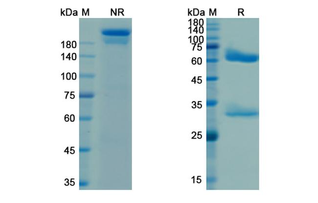 Pagibaximab Chimeric Antibody in SDS-PAGE (SDS-PAGE)
