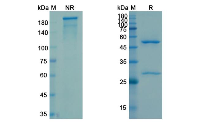 Raxibacumab Antibody in SDS-PAGE (SDS-PAGE)