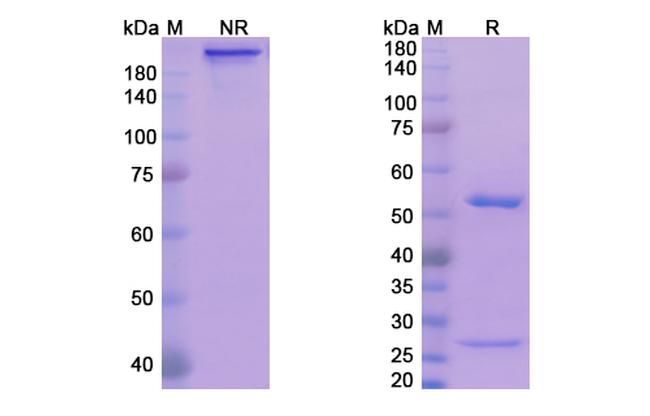 Exbivirumab Antibody in SDS-PAGE (SDS-PAGE)