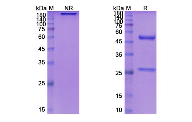 Siltuximab Chimeric Antibody in SDS-PAGE (SDS-PAGE)