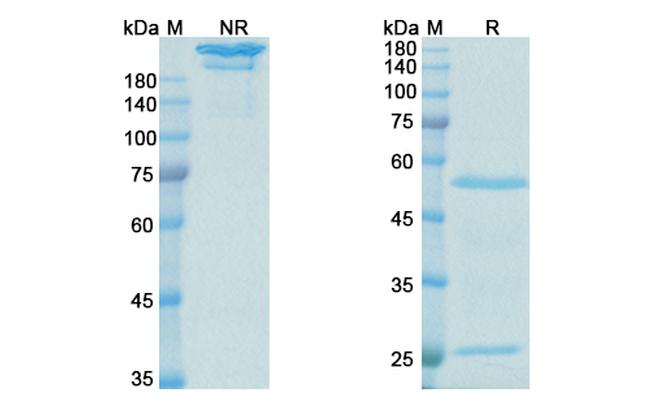 Lebrikizumab Humanized Antibody in SDS-PAGE (SDS-PAGE)