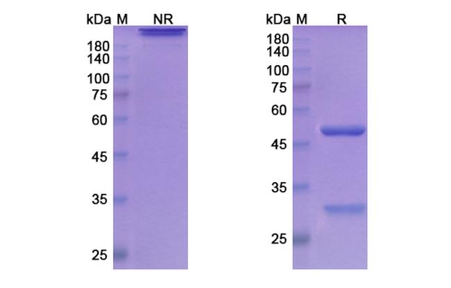 Atinumab Antibody in SDS-PAGE (SDS-PAGE)