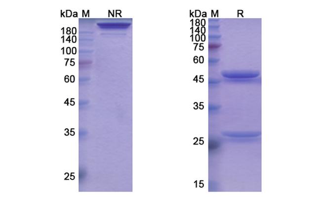 Tabalumab Antibody in SDS-PAGE (SDS-PAGE)