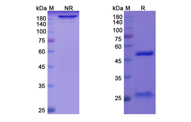 Quilizumab Humanized Antibody in SDS-PAGE (SDS-PAGE)