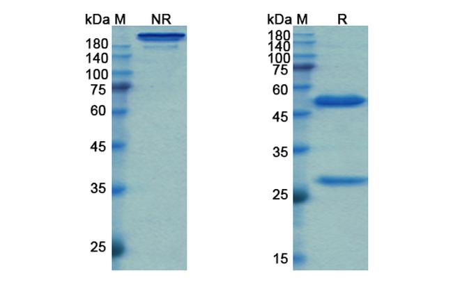 Simtuzumab Humanized Antibody in SDS-PAGE (SDS-PAGE)