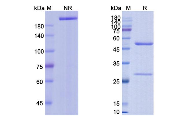 Vorsetuzumab Humanized Antibody in SDS-PAGE (SDS-PAGE)