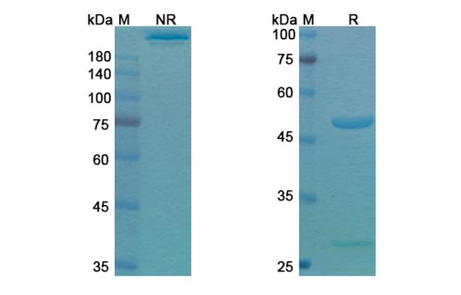 Setoxaximab Chimeric Antibody in SDS-PAGE (SDS-PAGE)