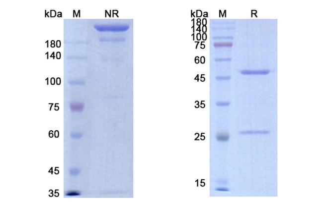 Imalumab Antibody in SDS-PAGE (SDS-PAGE)