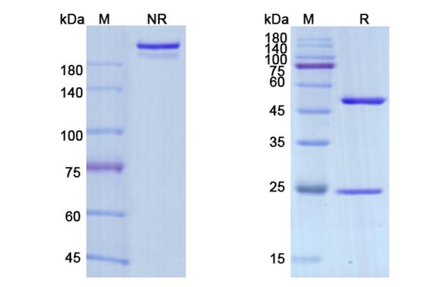 Avelumab Antibody in SDS-PAGE (SDS-PAGE)