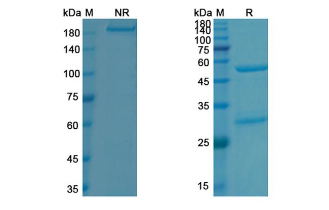 Evinacumab Antibody in SDS-PAGE (SDS-PAGE)