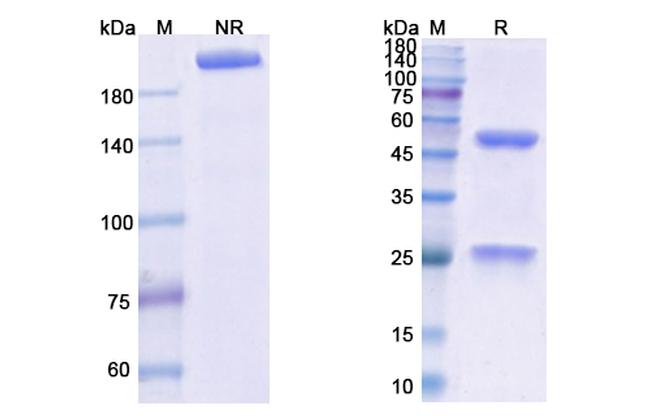 Obiltoxaximab Chimeric Antibody in SDS-PAGE (SDS-PAGE)