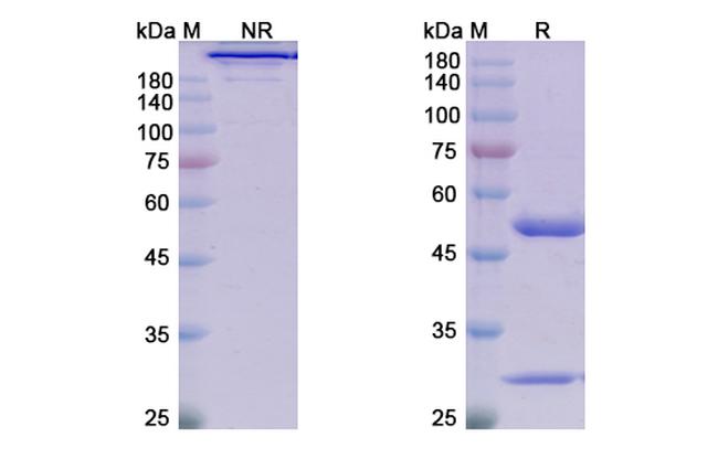 Satralizumab Humanized Antibody in SDS-PAGE (SDS-PAGE)