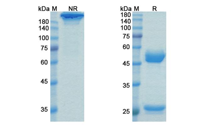 Talacotuzumab Humanized Antibody in SDS-PAGE (SDS-PAGE)