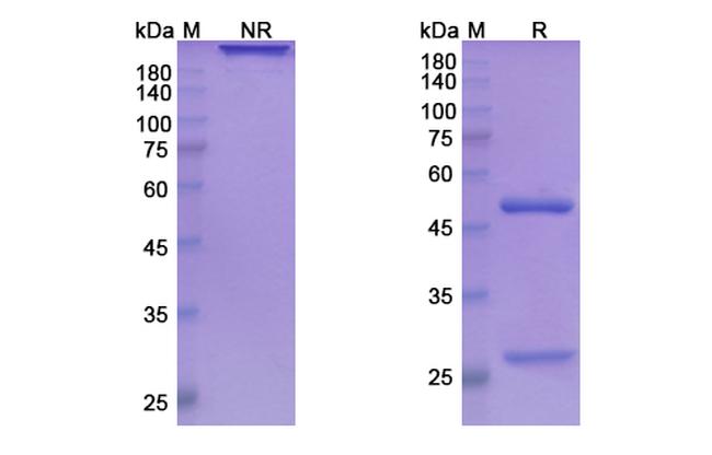 Ladiratuzumab Humanized Antibody in SDS-PAGE (SDS-PAGE)