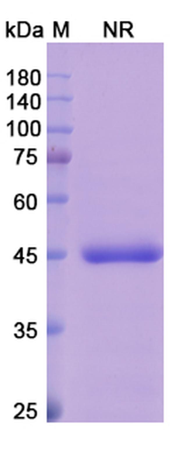 Abrezekimab Humanized Antibody in SDS-PAGE (SDS-PAGE)