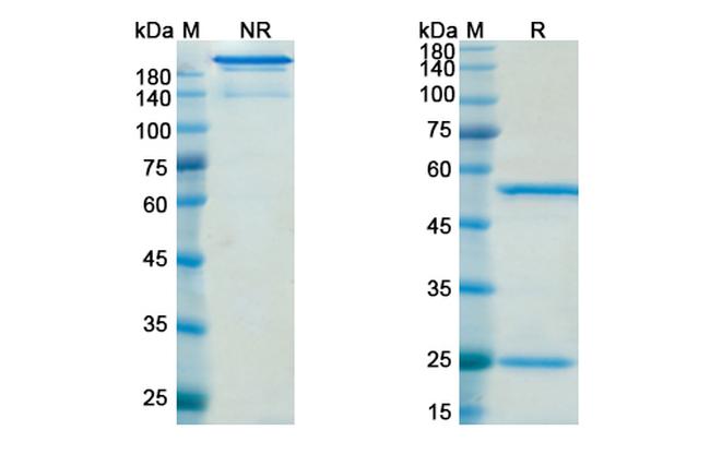 Quetmolimab Chimeric Antibody in SDS-PAGE (SDS-PAGE)