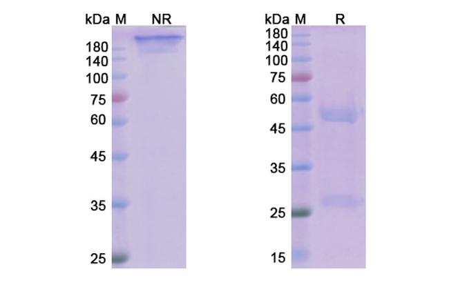 Avdoralimab Antibody in SDS-PAGE (SDS-PAGE)