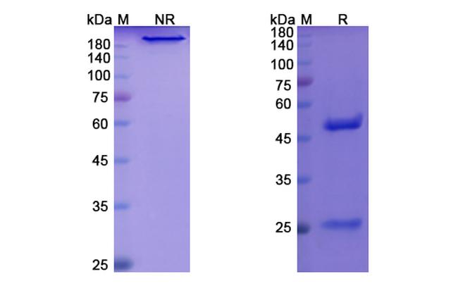 Benufutamab Chimeric Antibody in SDS-PAGE (SDS-PAGE)