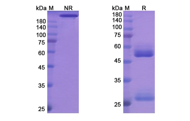 Odesivimab Antibody in SDS-PAGE (SDS-PAGE)