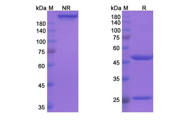 Tafolecimab Antibody in SDS-PAGE (SDS-PAGE)