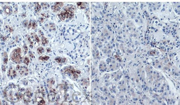 CA19-9 Antibody in Immunohistochemistry (Paraffin) (IHC (P))