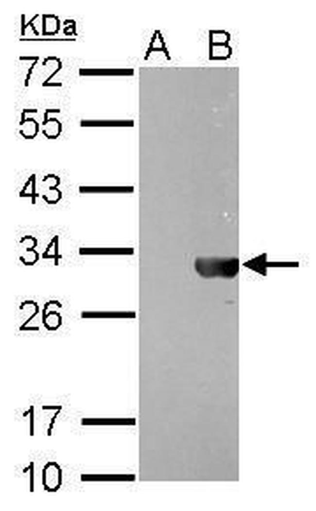 HSV Tag Antibody in Western Blot (WB)