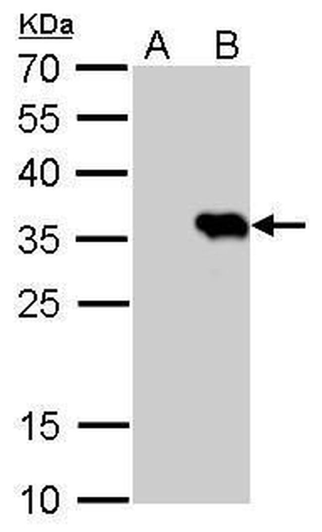 HSV Tag Antibody in Western Blot (WB)