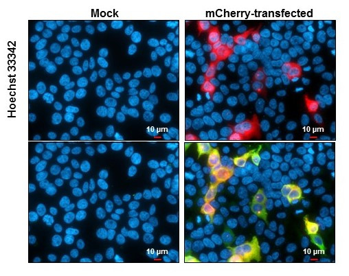 mCherry Antibody in Immunocytochemistry (ICC/IF)