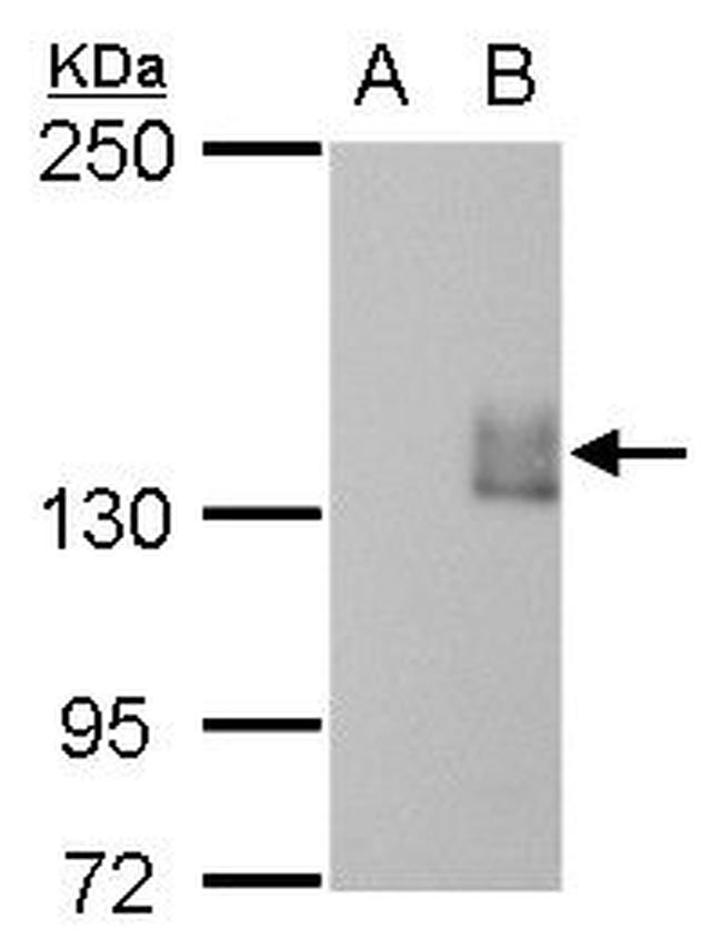 mCherry Antibody in Western Blot (WB)