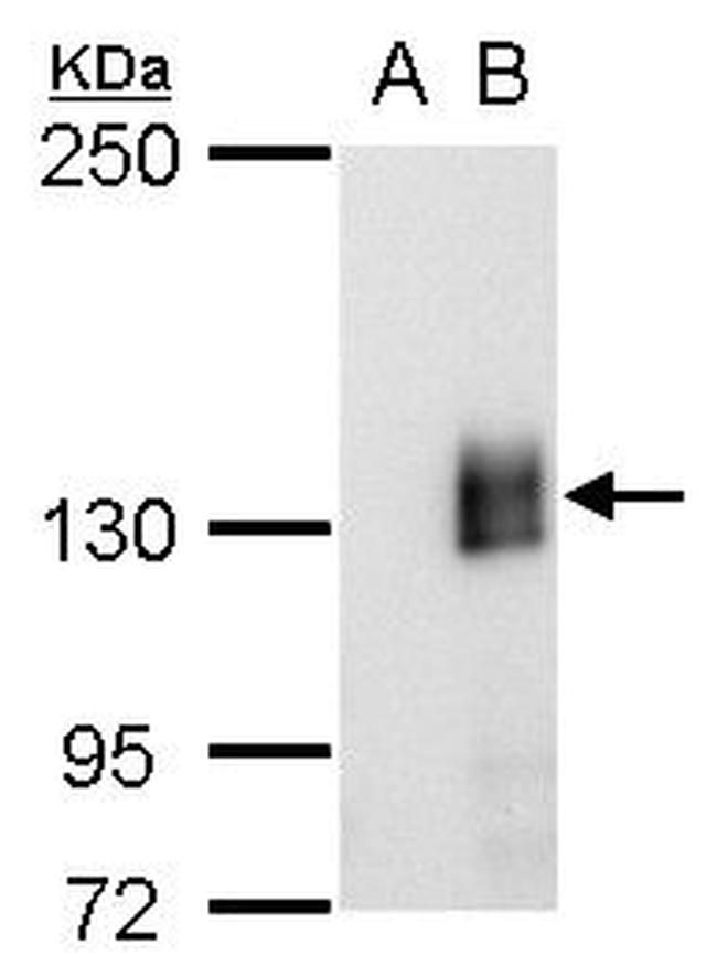 mCherry Antibody in Western Blot (WB)