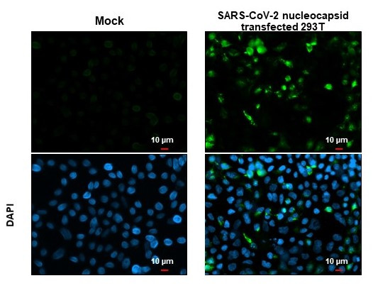 SARS/SARS-CoV-2 Nucleocapsid Antibody in Immunocytochemistry (ICC/IF)