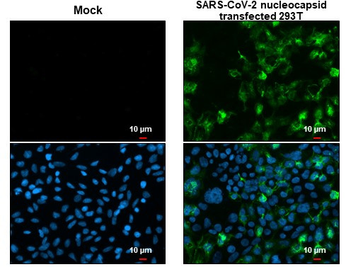 SARS/SARS-CoV-2 Nucleocapsid Antibody in Immunocytochemistry (ICC/IF)