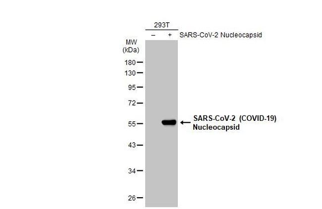 SARS/SARS-CoV-2 Nucleocapsid Antibody in Western Blot (WB)