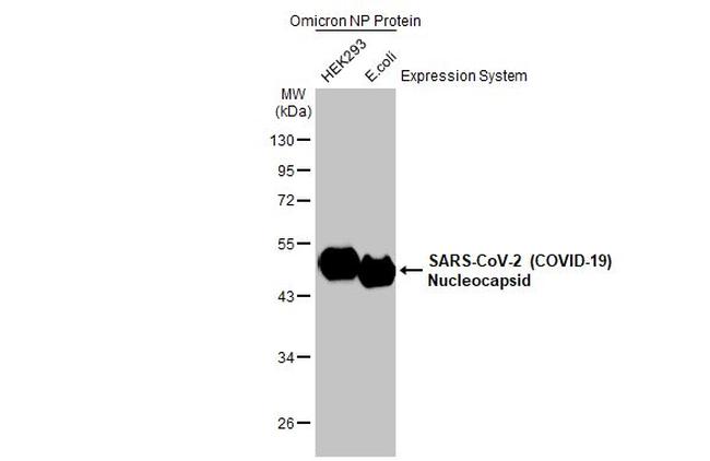 SARS/SARS-CoV-2 Nucleocapsid Antibody in Western Blot (WB)