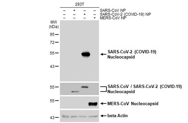 SARS/SARS-CoV-2 Nucleocapsid Antibody in Western Blot (WB)