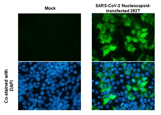 SARS/SARS-CoV-2 Nucleocapsid Antibody in Immunocytochemistry (ICC/IF)