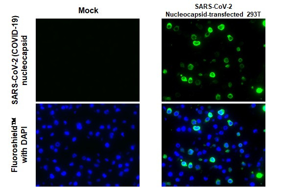 SARS/SARS-CoV-2 Nucleocapsid Antibody in Immunohistochemistry (Paraffin) (IHC (P))