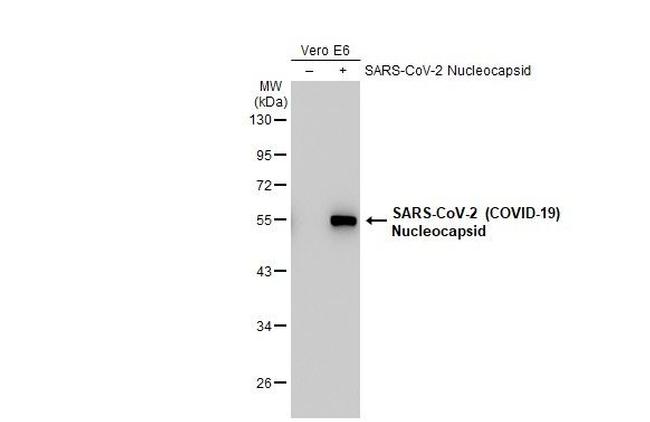 SARS/SARS-CoV-2 Nucleocapsid Antibody in Western Blot (WB)