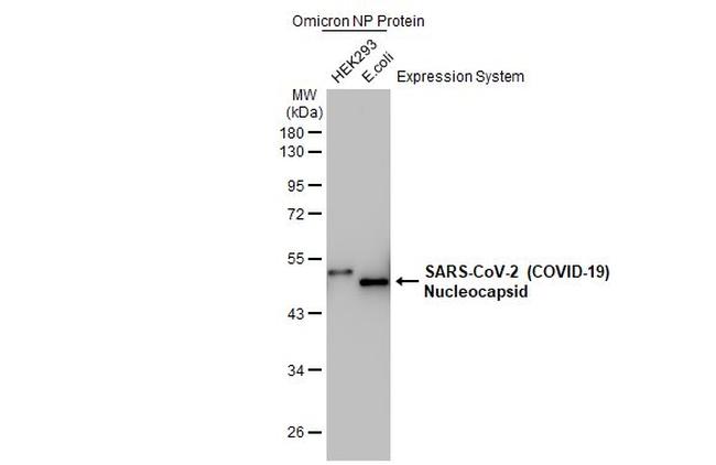 SARS/SARS-CoV-2 Nucleocapsid Antibody in Western Blot (WB)